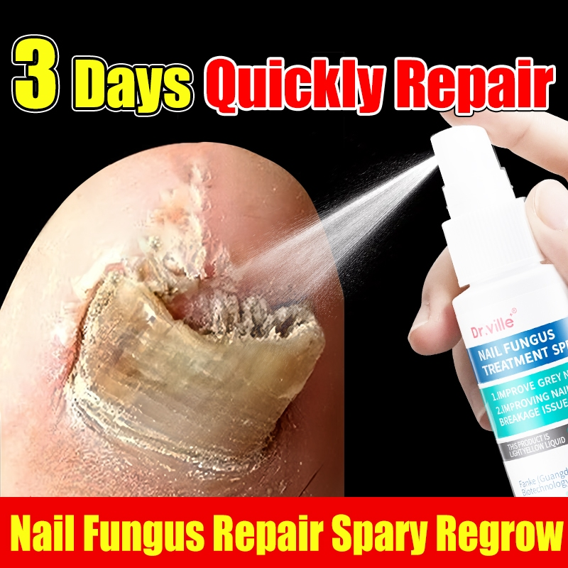 #50% Off Event! Limited time offer! Gray nails, thin nails, nourishment, bacteria, no more worries with this one!