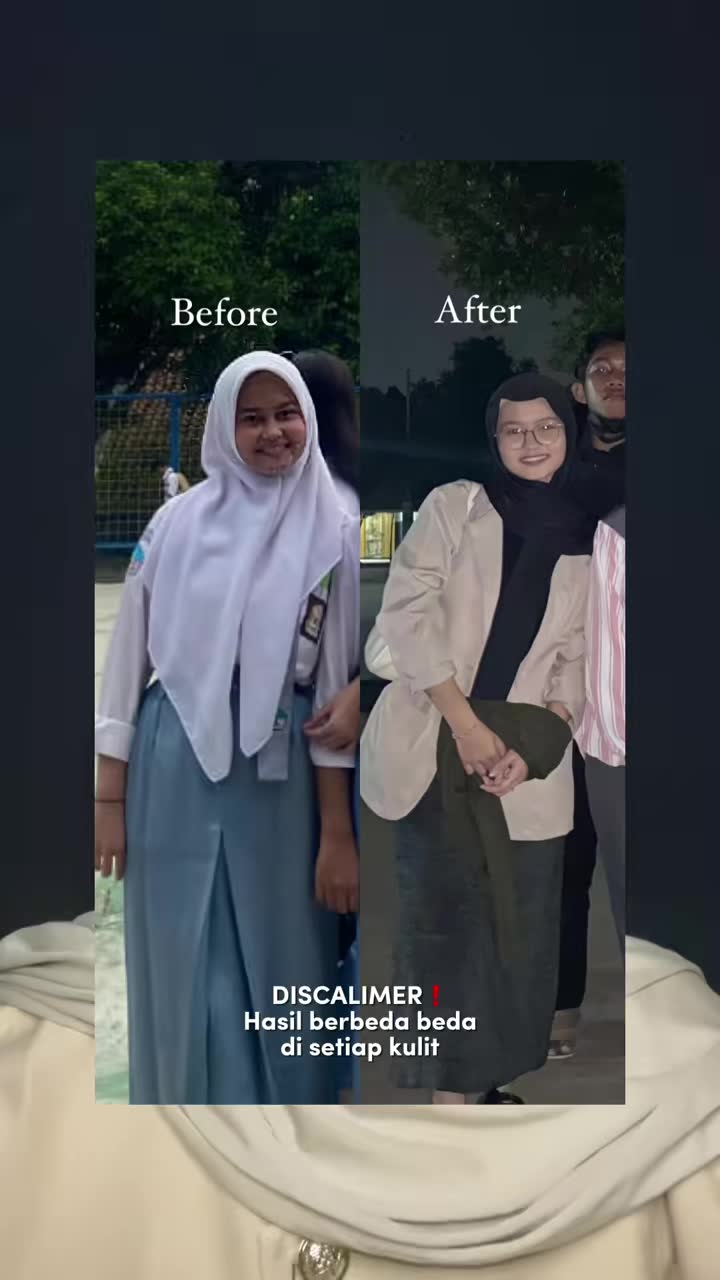 Membalas  udah pasti 10000/10 dongg🥹😝😘🫶🏻  
 
    #BeTheNewYou #NourishYourSkin #Cglutaboost #Newlab